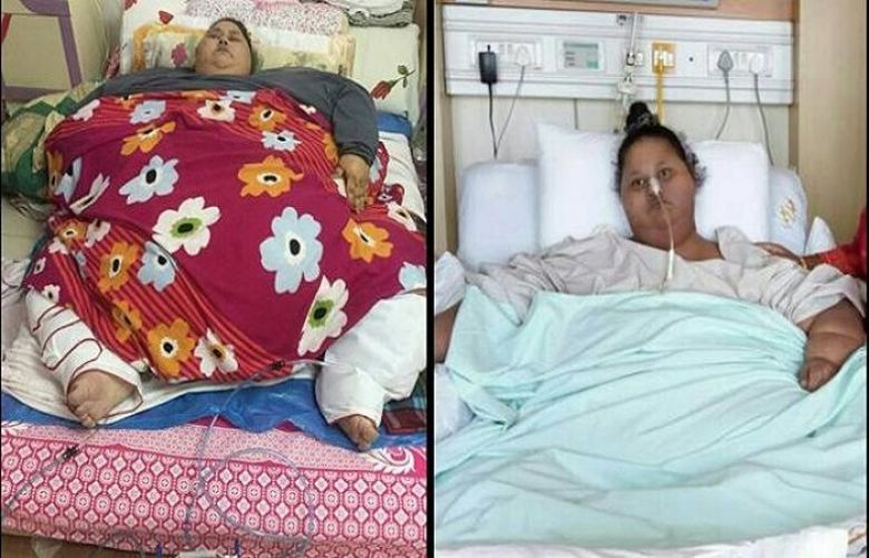 Before and after: Eman Abd el-Aty lies in her hospital bed