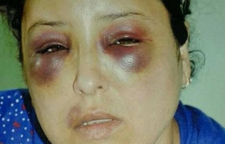 bir Ahmad Khalil was brutally assaulted after she refused to give them cigarettes for free.