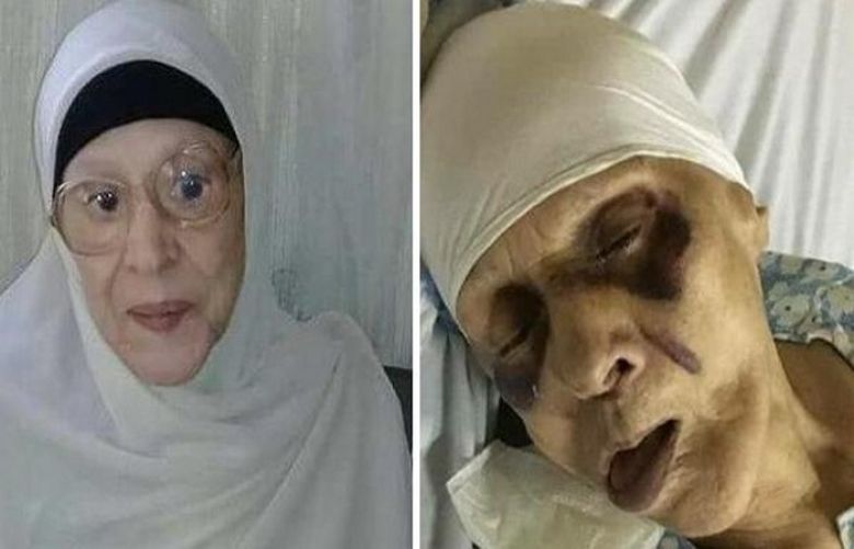 Zeinab died in El-Mabarra Hospital in Port Said after suffering from a brain clot.