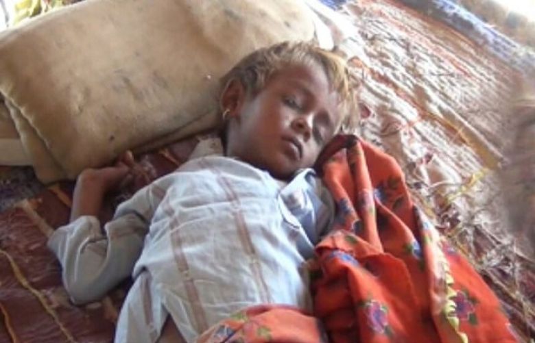 Measles outbreak has affected dozens of children in Mithoo gypsy colony near Umerkot.