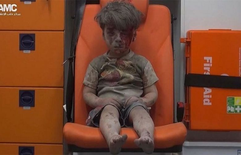New photos emerge of Omran Daqneesh, the boy who became a symbol of Aleppo&#039;s suffering
