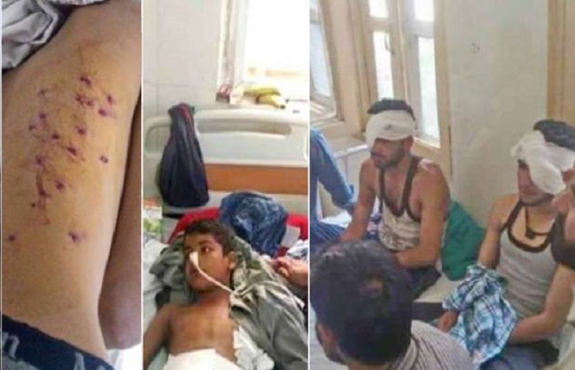  ہندوستانی فوج کی فائرنگ سے زخمی ہونے والے نوجوان ہسپتال میں زیرعلاج
