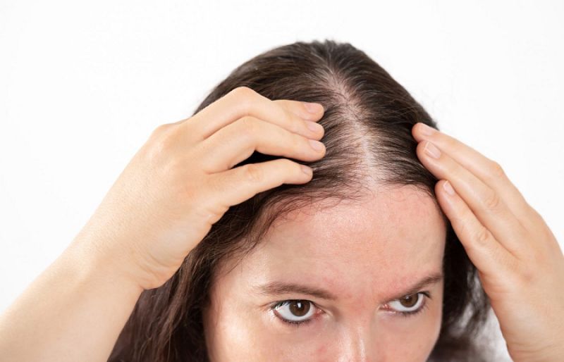 Hair loss: Causes, treatment & prevention