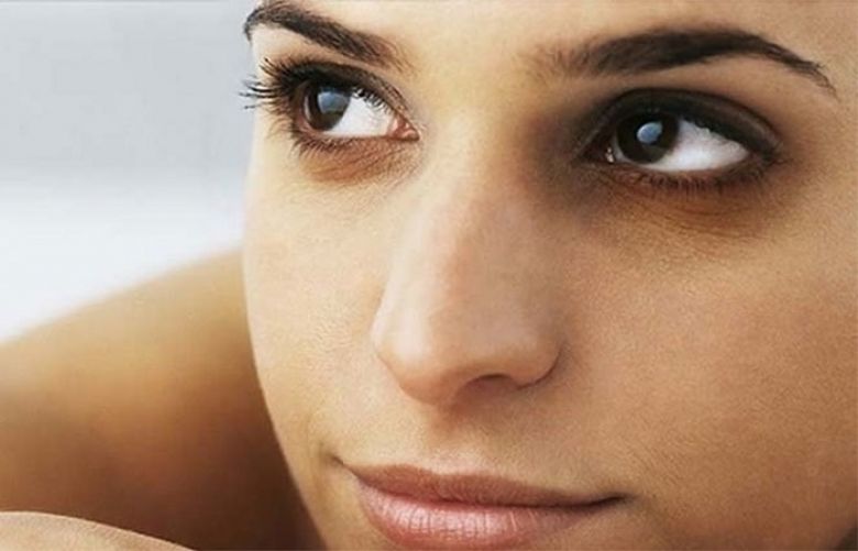 Dark Circles Under The Eyes — What You Can Do