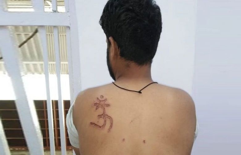 Muslim man under trial in an Indian jail has complained that he was beaten and branded with an &#039;Om