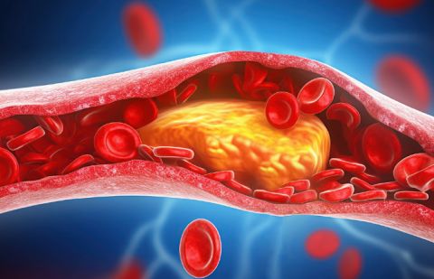High cholesterol is often described by medical experts as a “silent” health condition