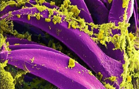 Yersinia pestis is the bacteria that causes plague.