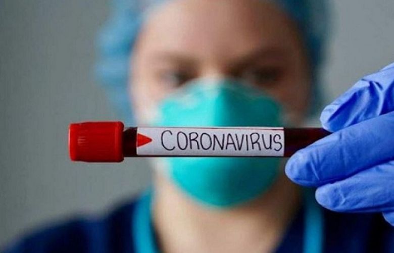 Nine more die from coronavirus, 566 test positive in 24 hours