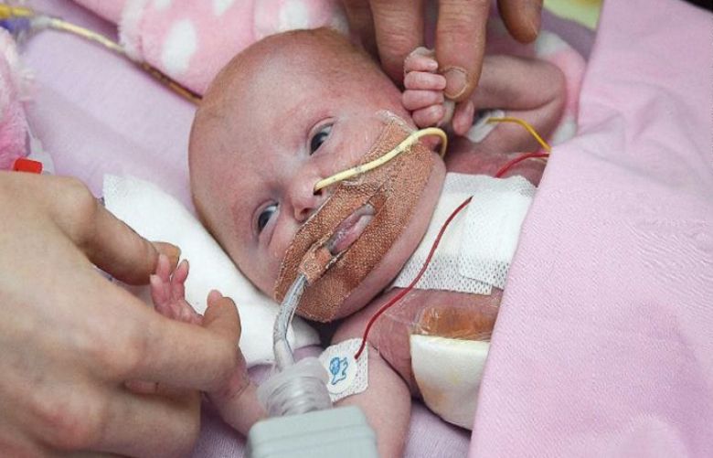 A baby born with her heart outside her body has survived surgery to insert it back into her chest.