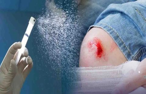  a new medical powder known as AGCL Powder