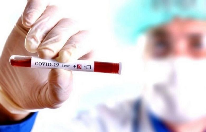 Coronavirus: 20 more people passes away 1000 fresh cases in pakistan