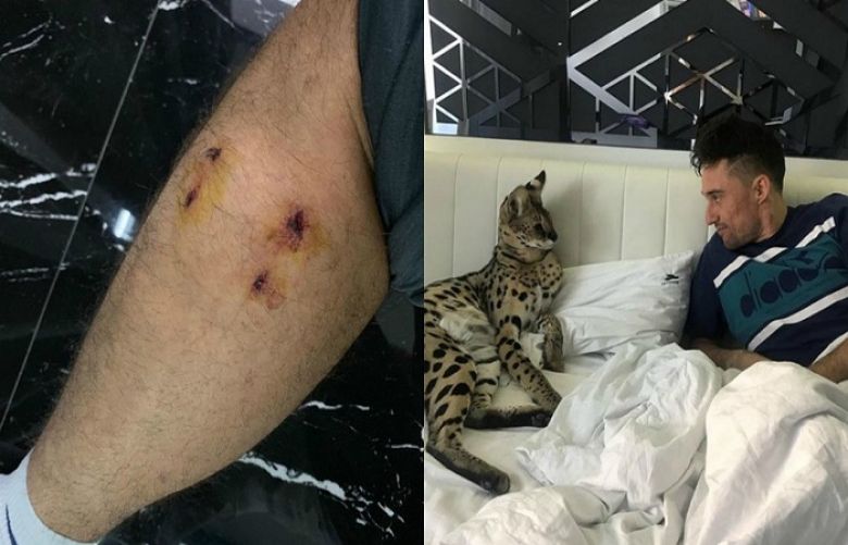 ‘It’s not your sweet cat!’ Ukrainian tennis star bitten by pet wild cat