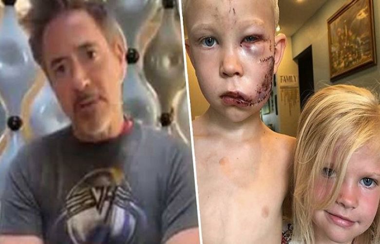 6-year-old hero who saved sister from dog attack