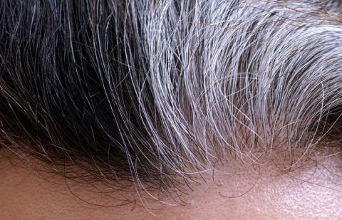 Some horrible causes of white hairs