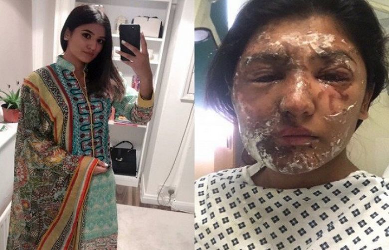 Resham Khan after and before her recovery