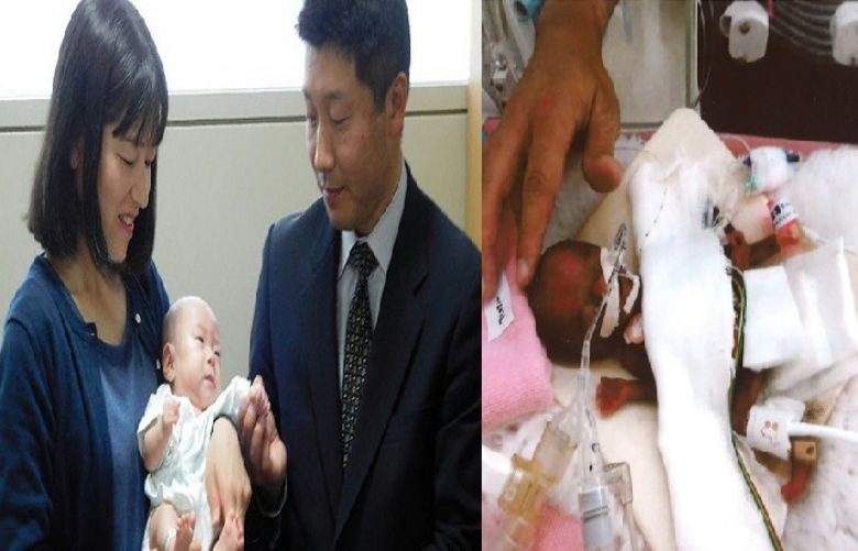The world´s smallest baby boy, was born in October in Japan weighing as much as an apple