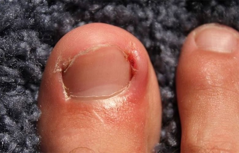 What Your Toenail Polish Color Says About You - wide 2