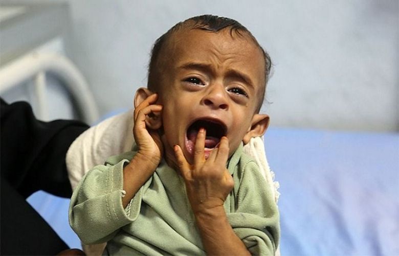 5,000 children killed or injured in Yemen war