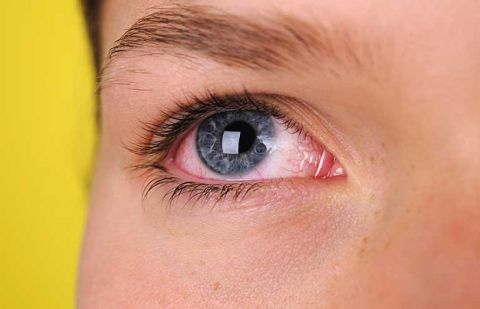 Early signs of heart disease appear in eyes