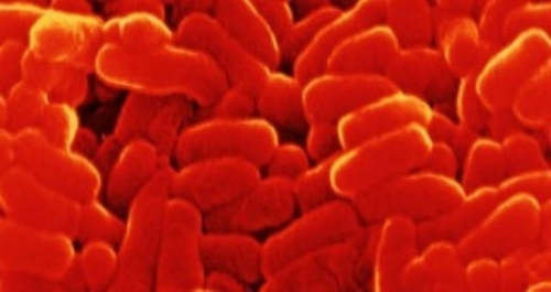 TB has human, not animal, origins - says study - BBC News