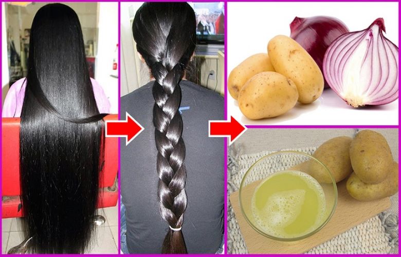 Onion juice helps hair growth