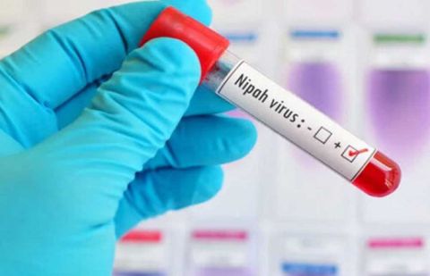 NIH issues advisory on Nipah virus