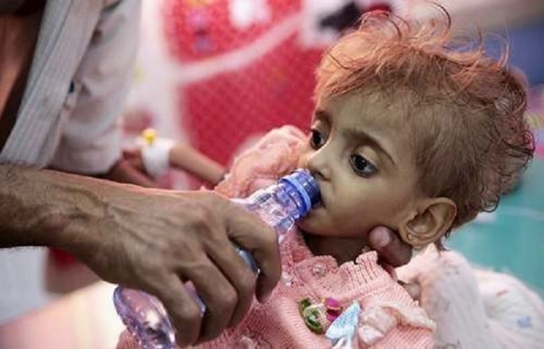 Food aid in a warehouse on the front lines of the Yemen war is at risk of rotting, the United Nations said on Monday, leaving millions of Yemenis without access to life-saving sustenance.