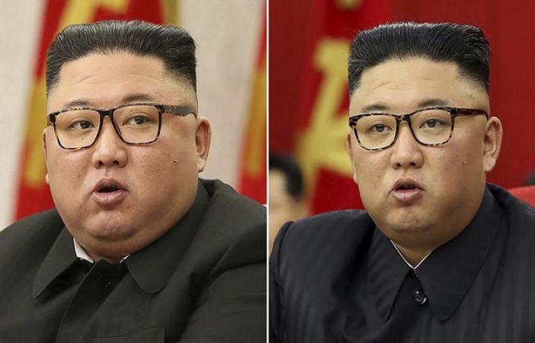 The health of North Korean leader Kim Jong Un