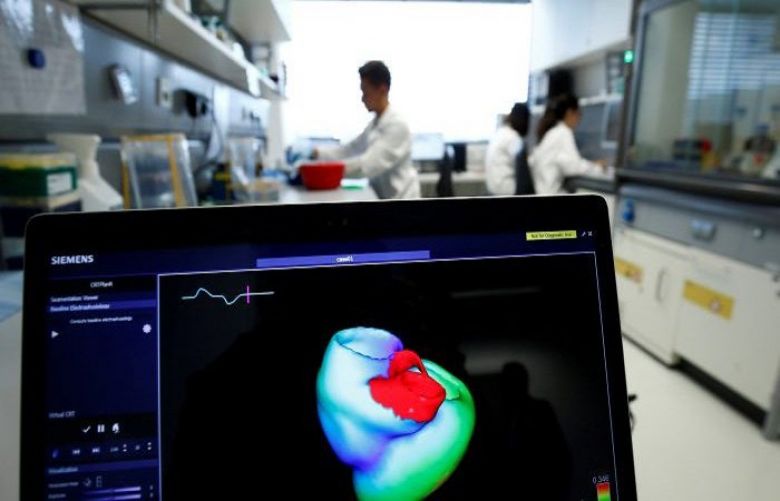 Tech breakthrough offers early warning system for heart attacks