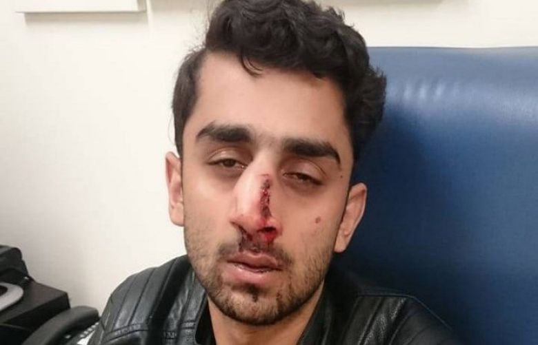 Pakistani student attacked at Australia&#039;s Newcastle university campus