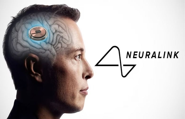Elon Musk&#039;s Neuralink 
