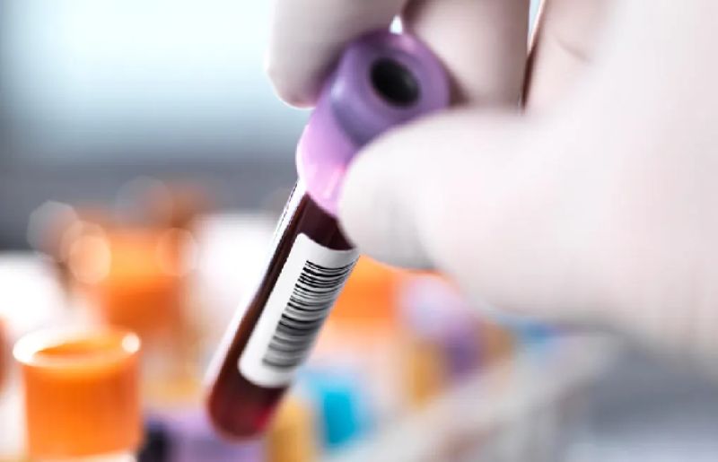 How do you find out your blood type if you don’t know?