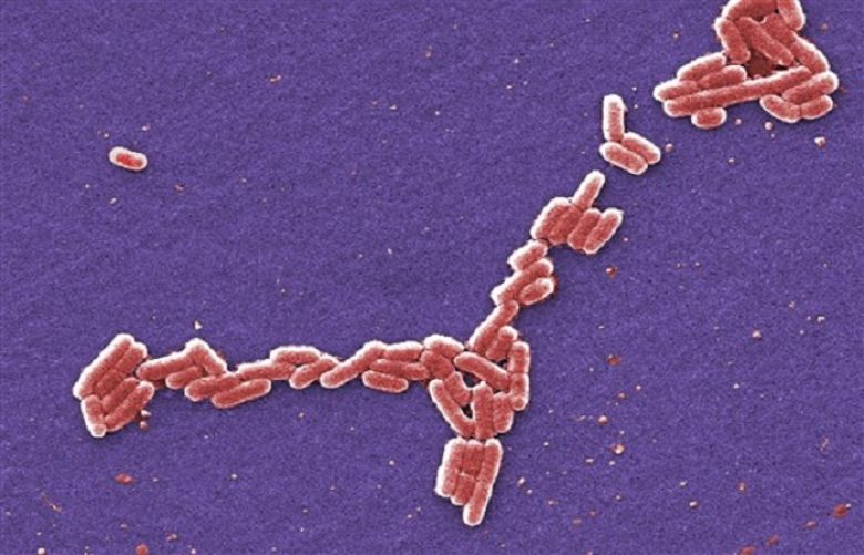 First death reported in romaine lettuce E. coli outbreak