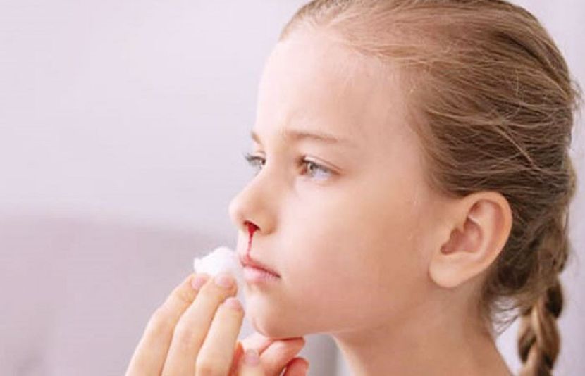 ناک سے خون آنا ایک عام مسئلہ ہے جو کسی بھی وقت ہو سکتا ہے