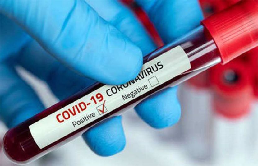  کورونا وائرس کیسز کی مثبت شرح میں پھر اضافہ