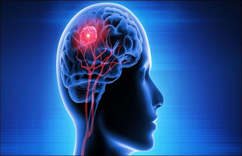 کینسر کے خلاف نئی تحقیق، علاج میں مثبت نتائج