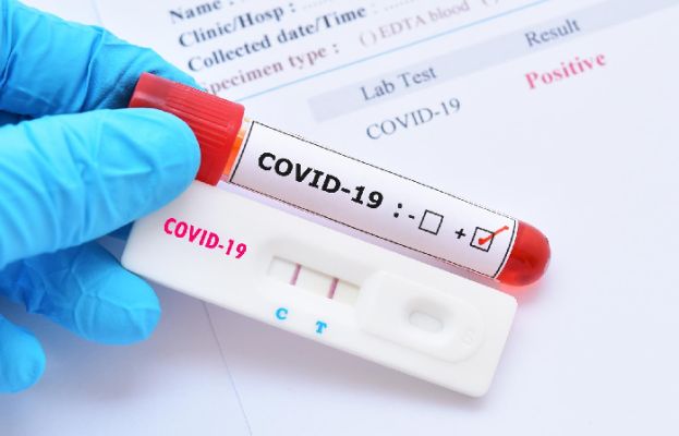 ملک میں 24 گھنٹوں کے دوران کورونا وائرس کے 28 کیس رپورٹ 