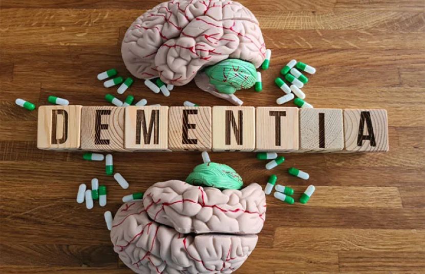 روزانہ کی خوراک میں الٹرا پروسیسڈ غذاؤں کا صرف 10 فیصد اضافہ ڈیمینشیا کا خطرہ بڑھا سکتا ہے