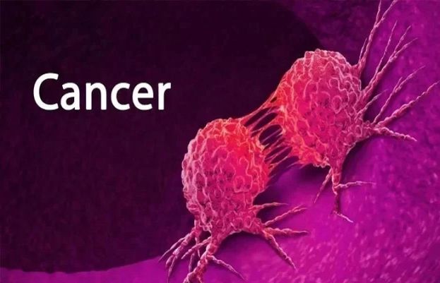 پھیپڑوں کا کینسر دنیا میں سرطان کی سب سے زیادہ عام قسم ہے