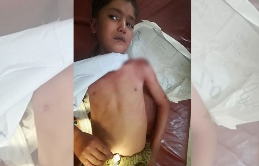 بھارتی فوج کی بلا اشتعال فائرنگ، 8 سالہ بچہ شدید زخمی