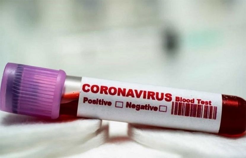 کورونا وائرس کے علاج کے لیے ایک عام دوا دریافت