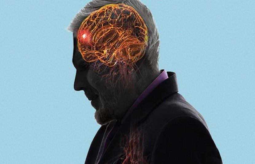 طبی ماہرین نے خبردار کیا ہے کہ مِنی اسٹروک یا ٹرانزینٹ اسکیمک اٹیک ٹی آئی اے کو معمولی نہ سمجھا جائے