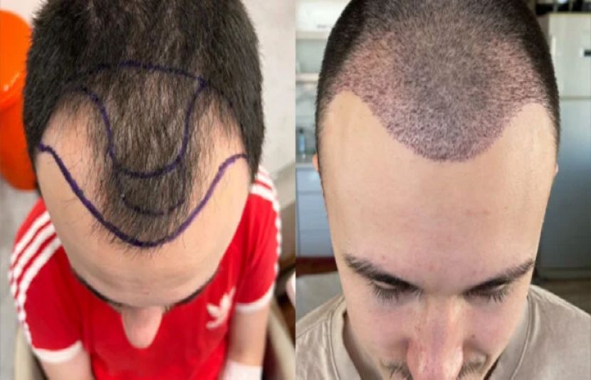 خوبصورتی کے بدلے موت؟