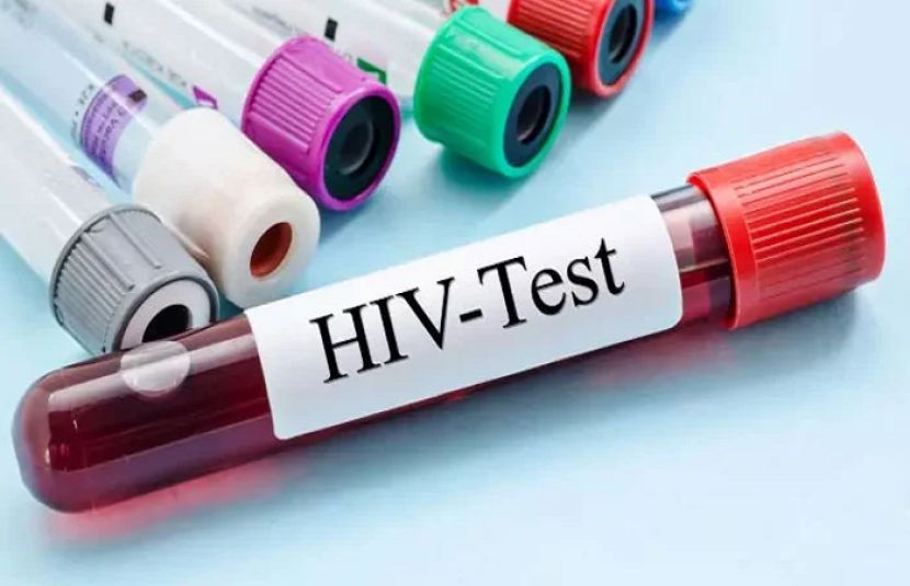 وفاقی وزیر صحت سید مصطفیٰ کمال نے پاکستان میں ایچ آئی وی ایڈز کے رجسٹرڈ مریضوں کی تعداد بتادی