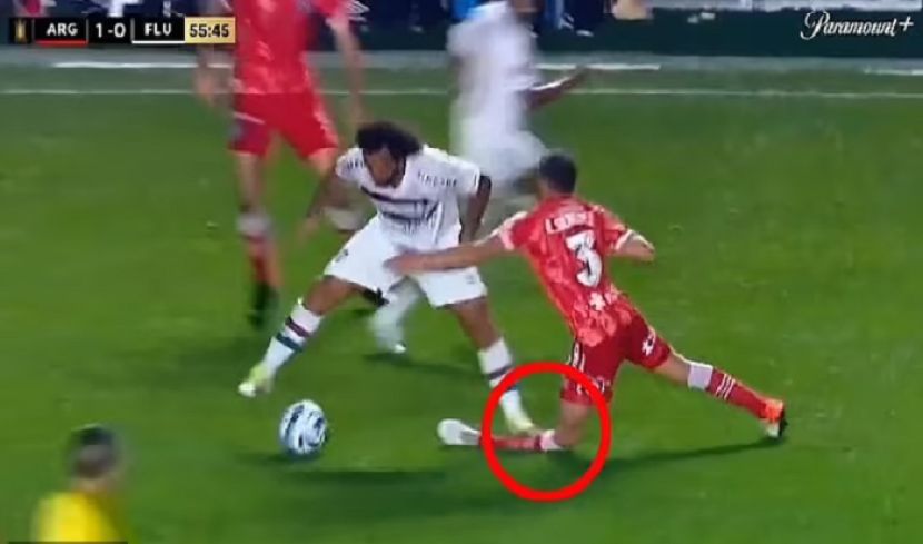 فٹبال میچ کے دوران ساتھی کھلاڑی کی ٹکر سے حریف پلئیر کی ٹانگ ٹوٹ گئی