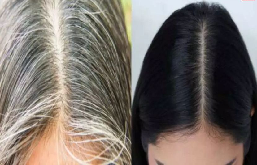 سفید بالوں کو سیاہ کرنے کا آسان نسخہ