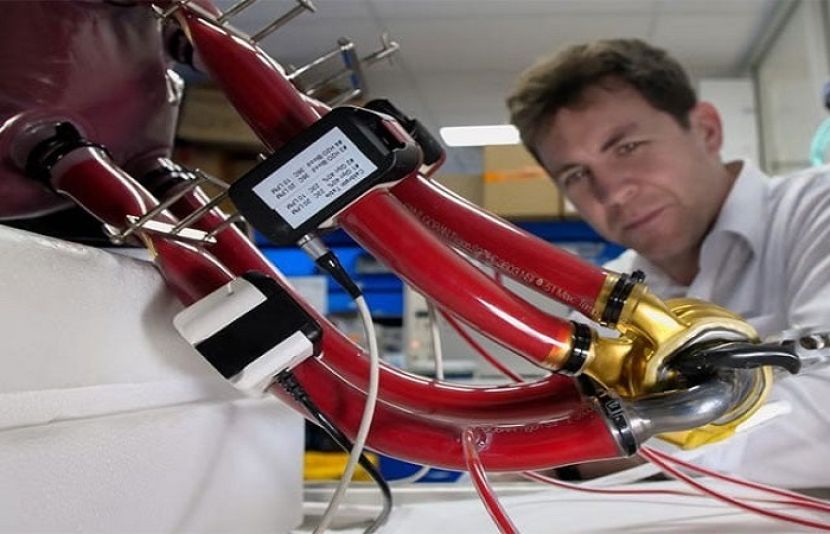 امریکا میں ایک شخص دل ناکارہ ہوجانے کی صورت میں کامیابی کے ساتھ دھاتی دل لگوانے والا پہلا انسان بن گیا