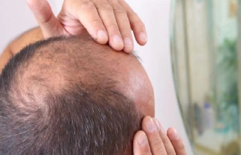 قدیم چینی طب میں استعمال ہونے والی ایک جڑ گنج پن کا علاج کر سکتی ہے