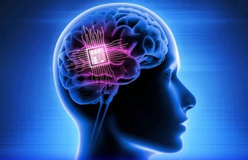 ایلون مسک کی کمپنی نیورا لنک پہلی مرتبہ انسانی دماغ میں وائر لیس برین چپ نصب کرنے میں کامیاب ہوگئی