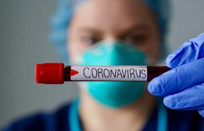 پاکستان میں کورونا وائرس سے مزید9 افراد جان کی بازی ہار گئے